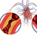 Ipertensione e livelli di colesterolo: una panoramica